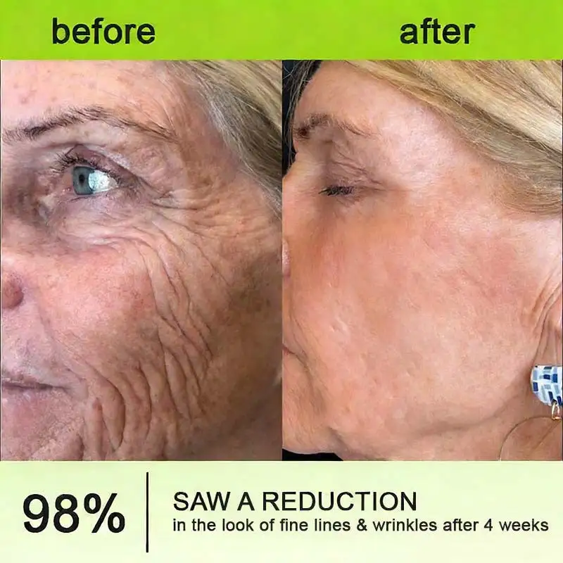 🧠👨⚕️Made and shipped from the USA moringa & Vita-A Retinol Shot Wrinkle-Lift Tightening cream - Last Day Promotion 50% OFF - Image 12