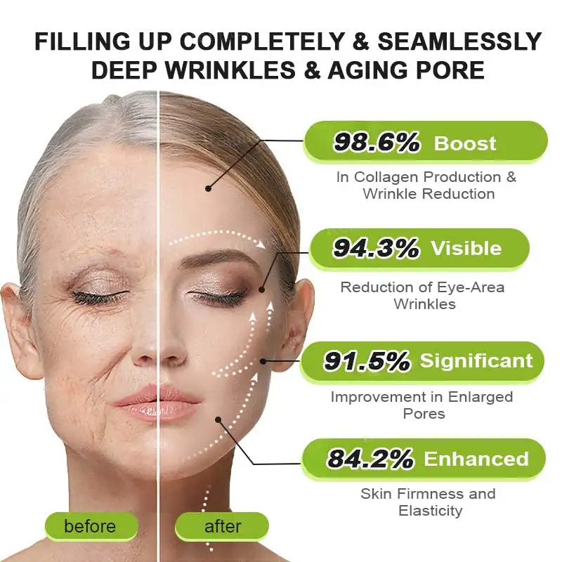 🧠👨⚕️Made and shipped from the USA moringa & Vita-A Retinol Shot Wrinkle-Lift Tightening cream - Last Day Promotion 50% OFF - Image 16