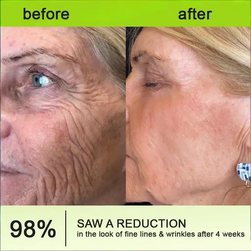 Made and shipped from the USA - Botin & Vita-A Retinol Shot Wrinkle-Lift Tightening cream - Image 3