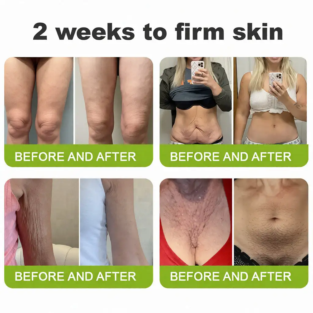 🧠👨⚕️Made and shipped from the USA Botin & Vita-A Retinol Shot Wrinkle-Lift Tightening cream - Last Day Promotion 70% OFF - Image 8