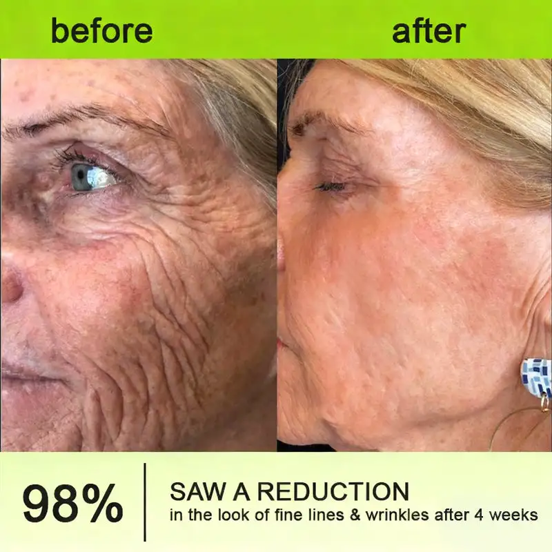 👏🌿 Made in the USA direct shipping Botox Vitamin A Retinol Anti-Wrinkle Firming and Lifting Cream — Last Day for Limited Time 70% OFF - Image 17