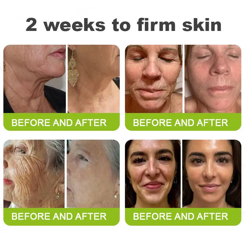 👏🌿 Made in the USA direct shipping Botox Vitamin A Retinol Anti-Wrinkle Firming and Lifting Cream — Last Day for Limited Time 70% OFF - Image 4