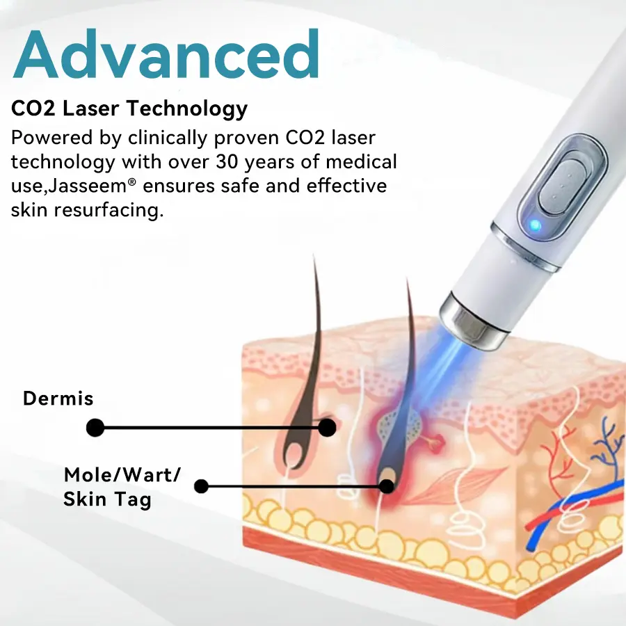 Medical-Grade Laser Pen - Image 9