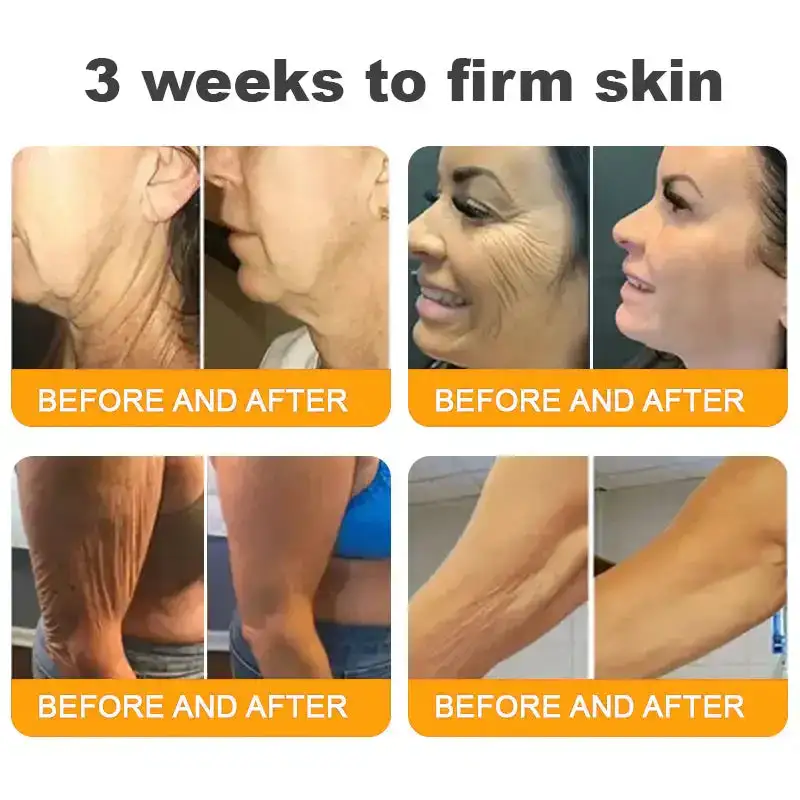 πππ πππ§π¨π¦ ππ₯π₯-π’π§-ππ§π ππ«πππ¦βπΈ Anti-aging,Hydrating, Skin Repair, Even Tone, Acne and Dark Spot Treatment, Wart and Mole Removal, Psoriasis Relief - Image 6