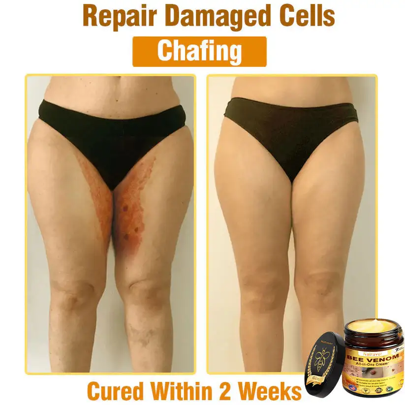 πππ πππ§π¨π¦ ππ₯π₯-π’π§-ππ§π ππ«πππ¦βπΈ Anti-aging,Hydrating, Skin Repair, Even Tone, Acne and Dark Spot Treatment, Wart and Mole Removal, Psoriasis Relief - Image 8