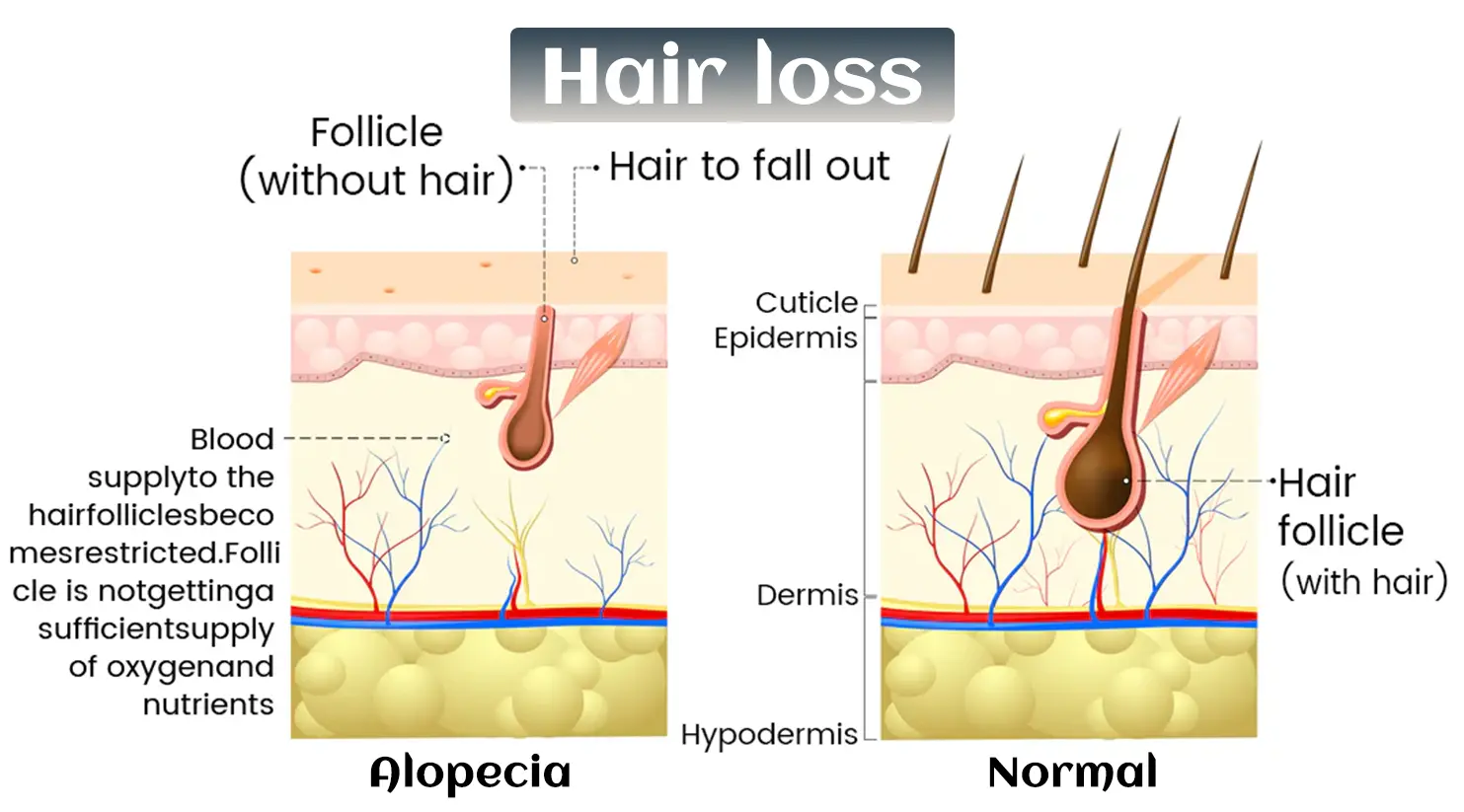 Biotin-Infused Hair & Beard Regrowth Atomizer -🔥7-Day Results - Image 8
