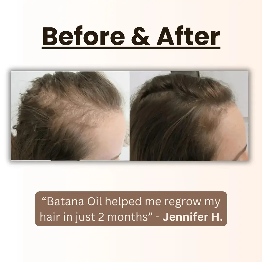 Natural Herbal Handcrafted Batana Oil Hair Growth Blend 4.2OZ - Image 3