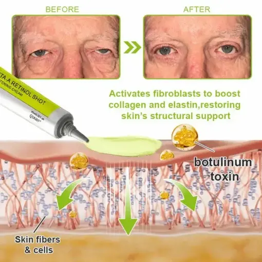 Advanced Peptide Botulinum-Style Vita-A Retinol Lifting Renewal Cream Today Only 70 OFF - Image 5