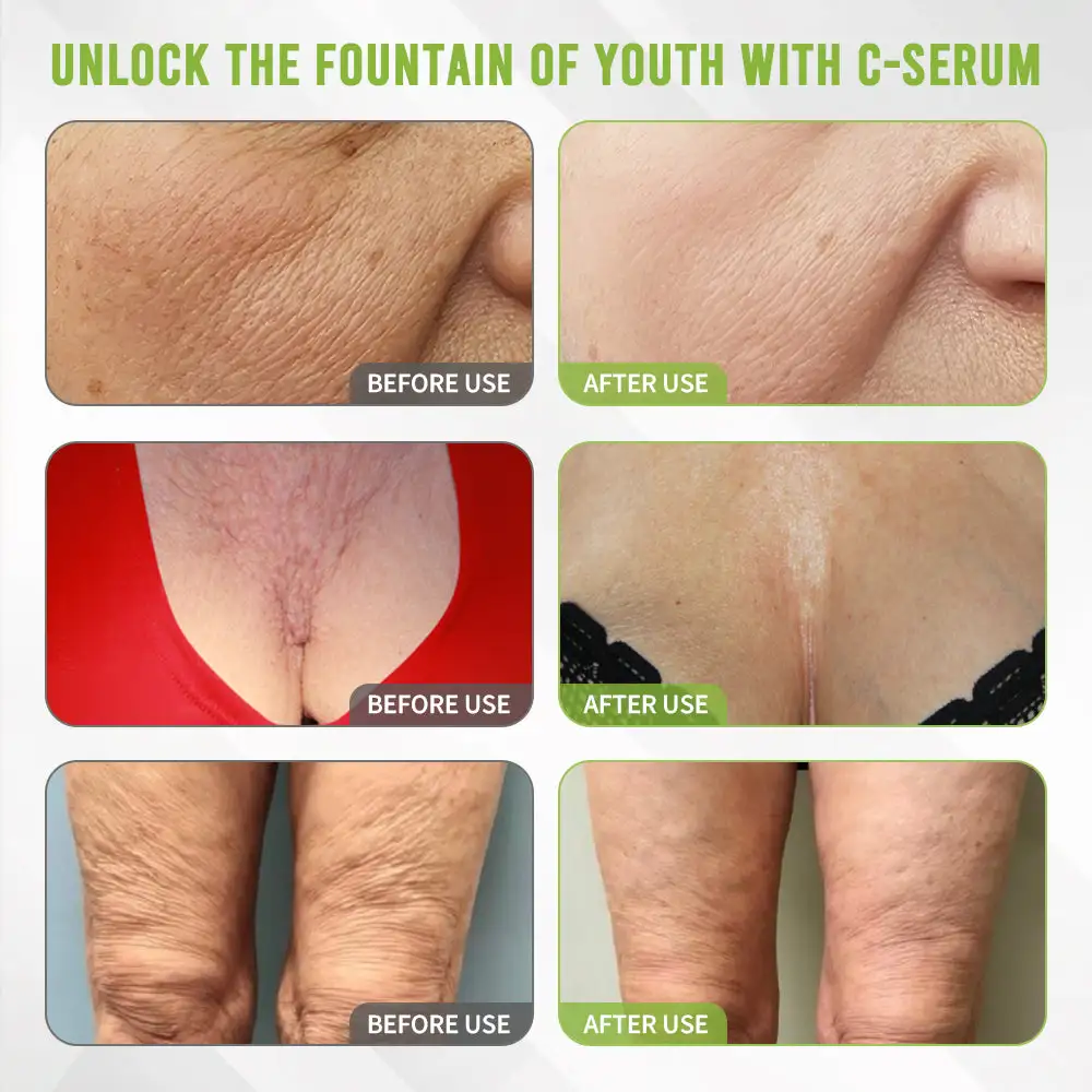 Kakadu Plum Skin Repair Serum - Image 2