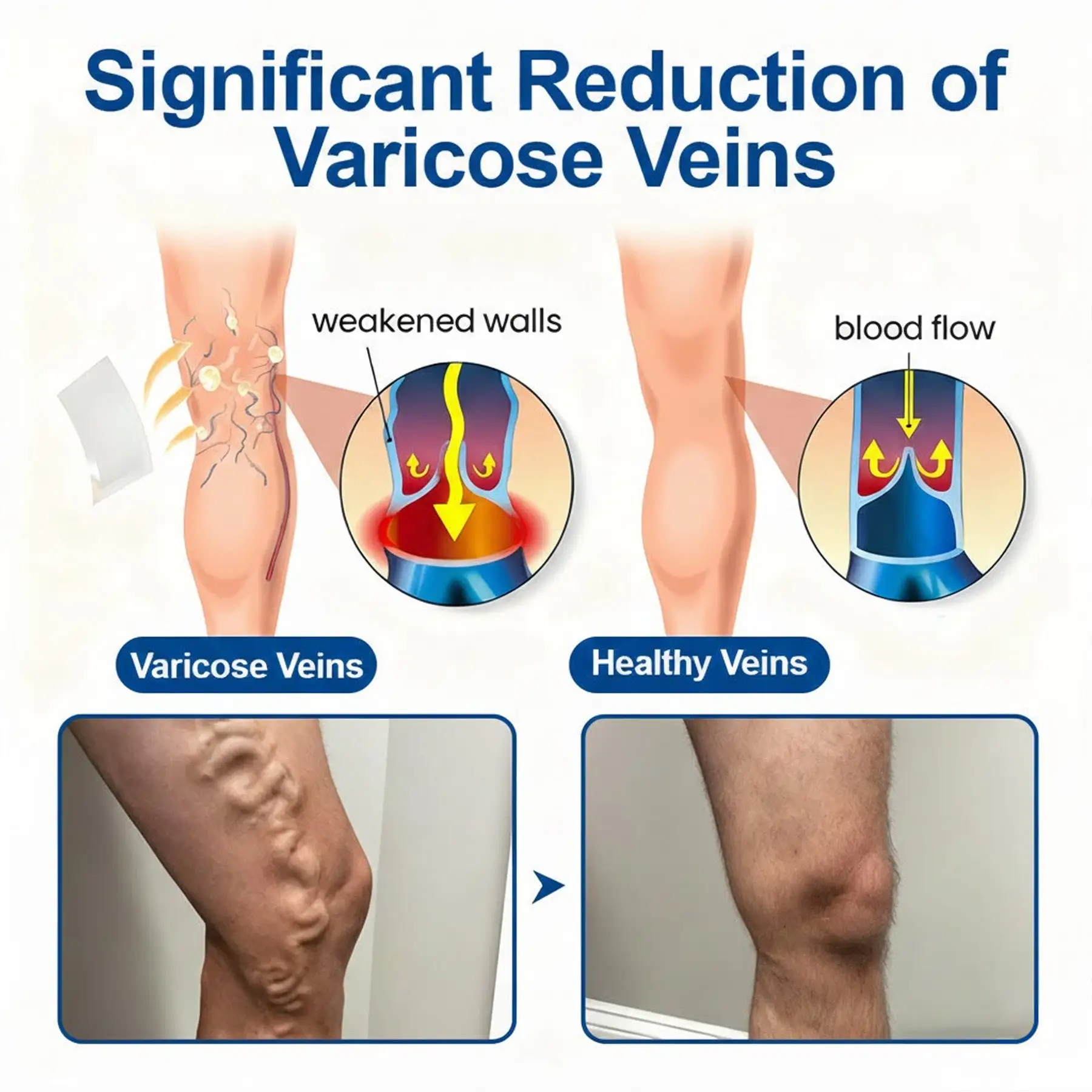 VeinEase Microneedle Care Patch - Image 4