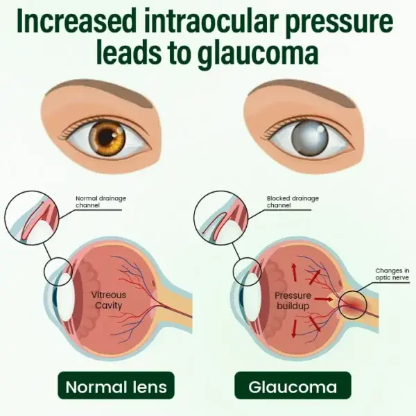 VisionClear Nano Eye Drops - Image 6