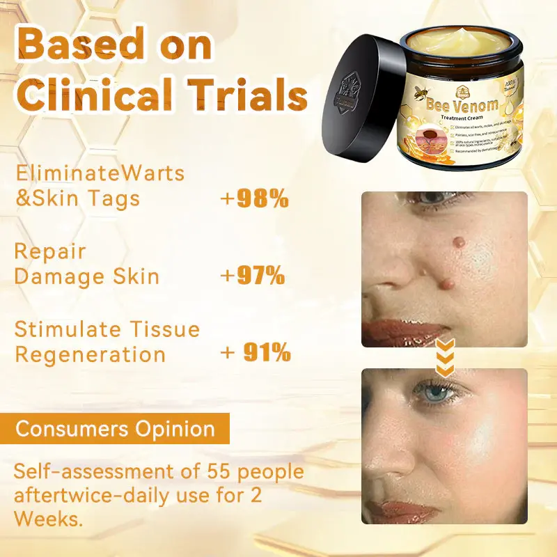 Aotearoa Bee Venom Skin Treatment Cream - Image 11