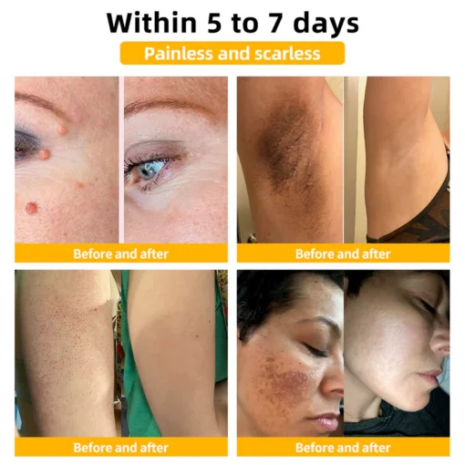Aotearoa Bee Venom Skin Treatment Cream - Image 3