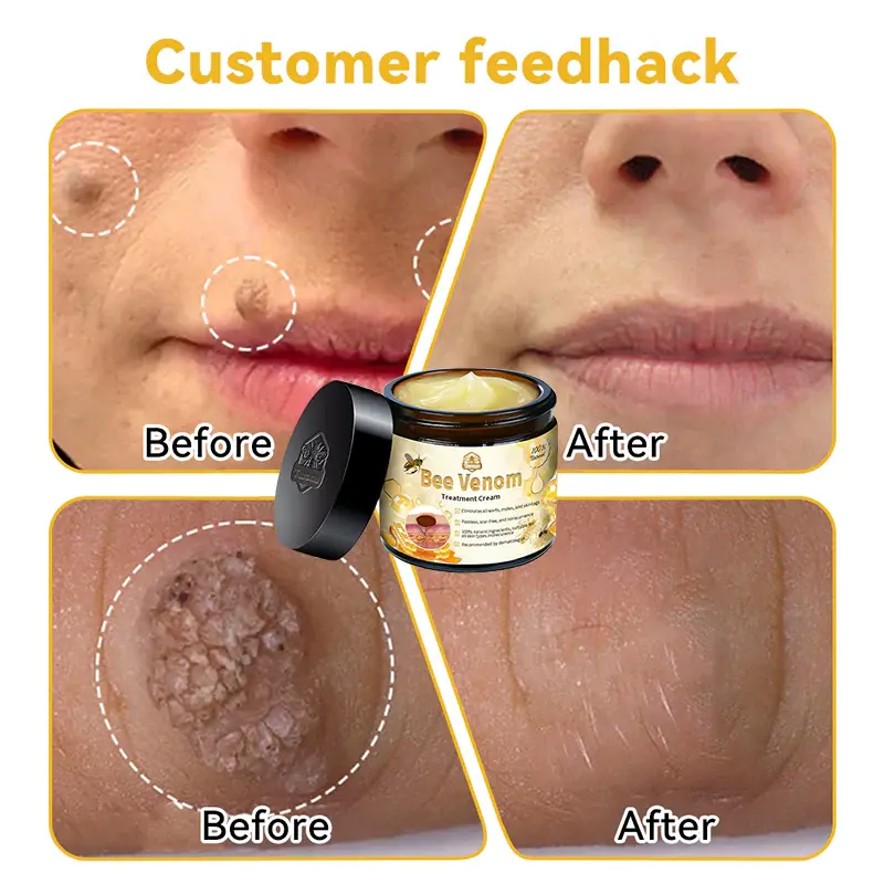 Aotearoa Bee Venom Skin Treatment Cream - Image 7