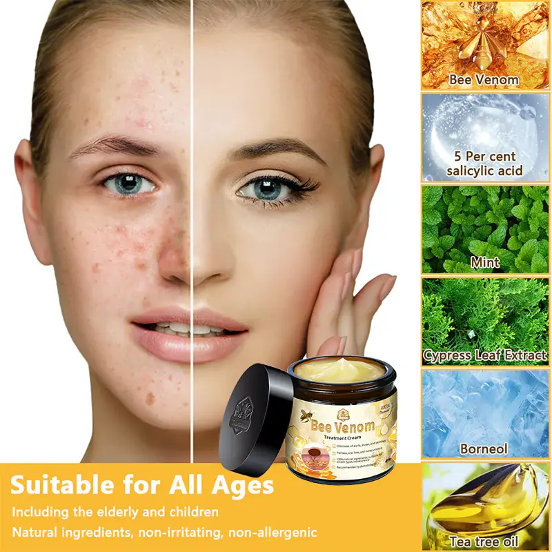 Aotearoa Bee Venom Skin Treatment Cream - Image 9