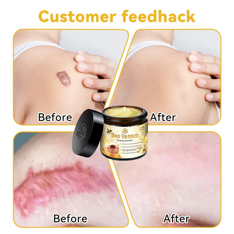 Bee Venom Advanced Skin Repair Cream - Image 5