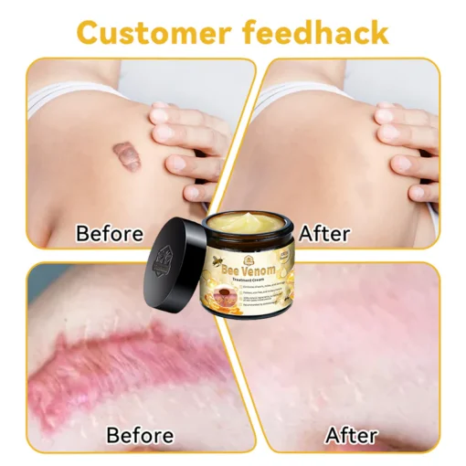 Bee Venom Advanced Skin Repair Cream - Image 5