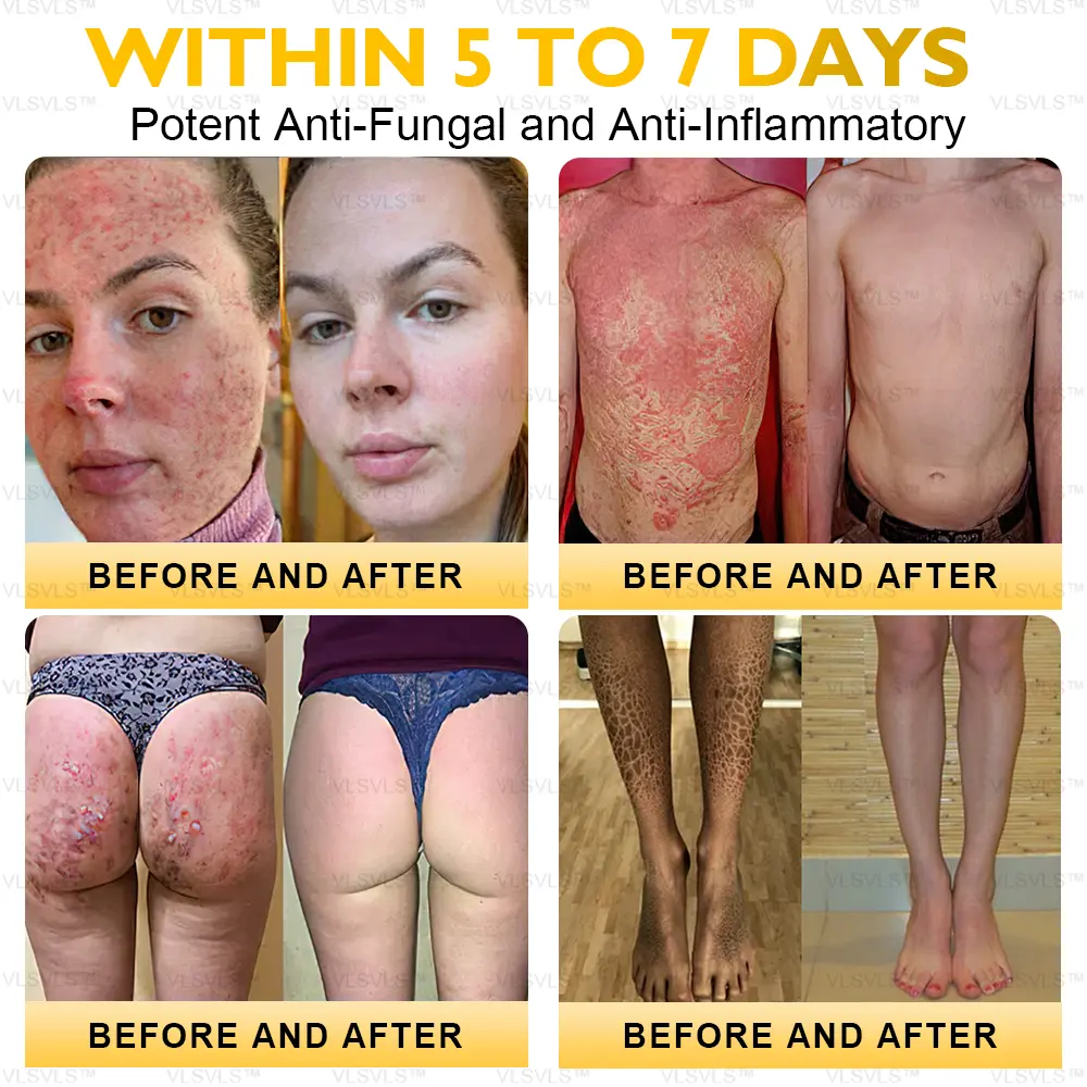 Ultimate All-Body Skin Restoration Cream - Image 6