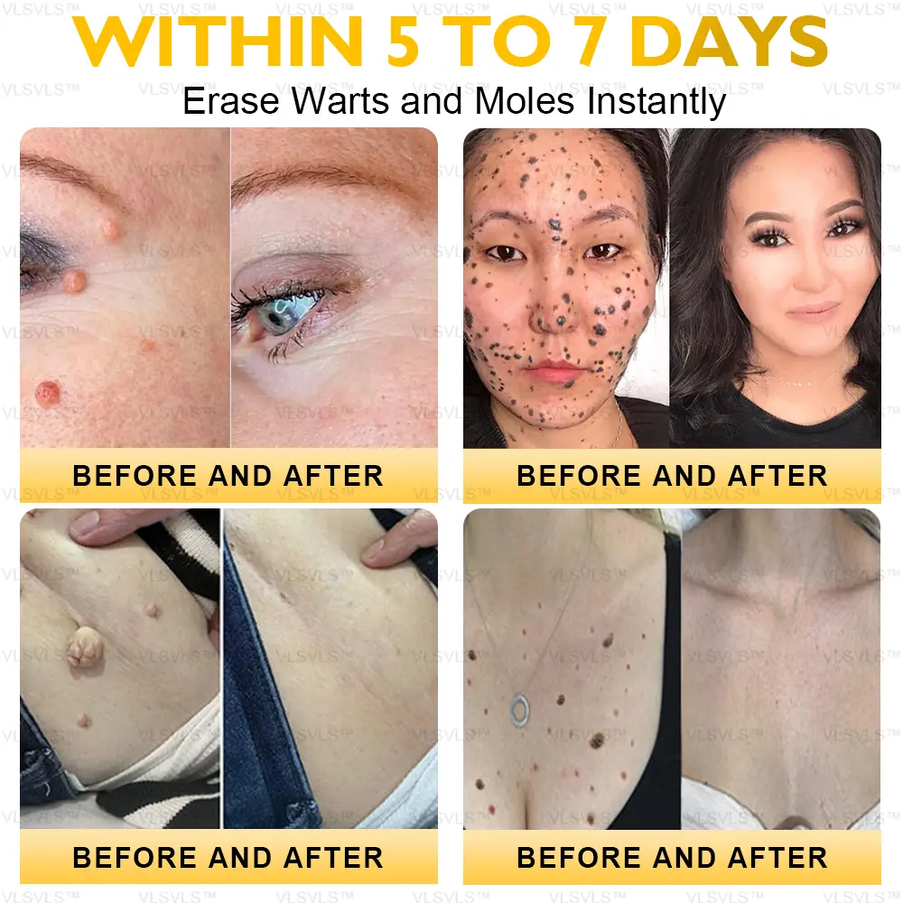 Ultimate All-Body Skin Restoration Cream - Image 8