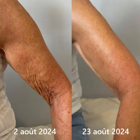 𝐂𝐫è𝐦𝐞 𝐑𝐚𝐟𝐟𝐞𝐫𝐦𝐢𝐬𝐬𝐚𝐧𝐭𝐞 𝐚𝐮 𝐂𝐨𝐥𝐥𝐚𝐠è𝐧𝐞 𝐝𝐞 𝐋𝐮𝐱𝐞 - Image 30