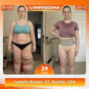 🎇🩳𝐎𝐟𝐟𝐢𝐜𝐢𝐚𝐥 𝐁𝐫𝐚𝐧𝐝 𝐒𝐭𝐨𝐫𝐞 |✅ EXPECTSKY® 𝟐𝟎𝟐𝟔 𝐌𝐨𝐫𝐢𝐧𝐠𝐚 & 𝐁𝐞𝐫𝐛𝐞𝐫𝐢𝐧𝐞 𝟒-𝐈𝐧-𝟏 𝐌𝐢𝐜𝐫𝐨-𝐏𝐚𝐫𝐭𝐢𝐜𝐥𝐞 𝐒𝐜𝐮𝐥𝐩𝐭𝐢𝐧𝐠 & 𝐅𝐚𝐭-𝐁𝐮𝐫𝐧 𝐒𝐡𝐨𝐫𝐭𝐬.💜