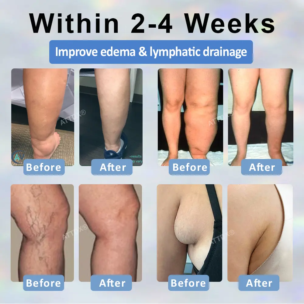 Black Cumin Edema Detox Herbal Cream - Image 2
