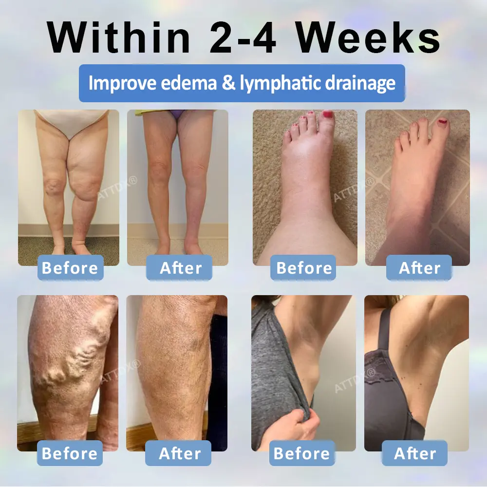 Black Cumin Edema Detox Herbal Cream - Image 3