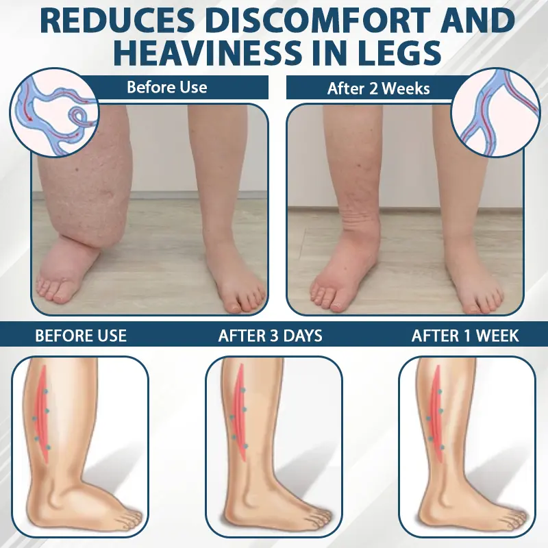 Black Cumin Edema Detox Herbal Cream - Image 6