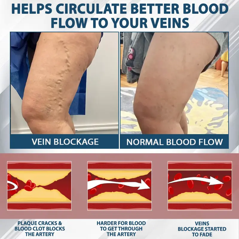 Black Cumin Edema Detox Herbal Cream - Image 8