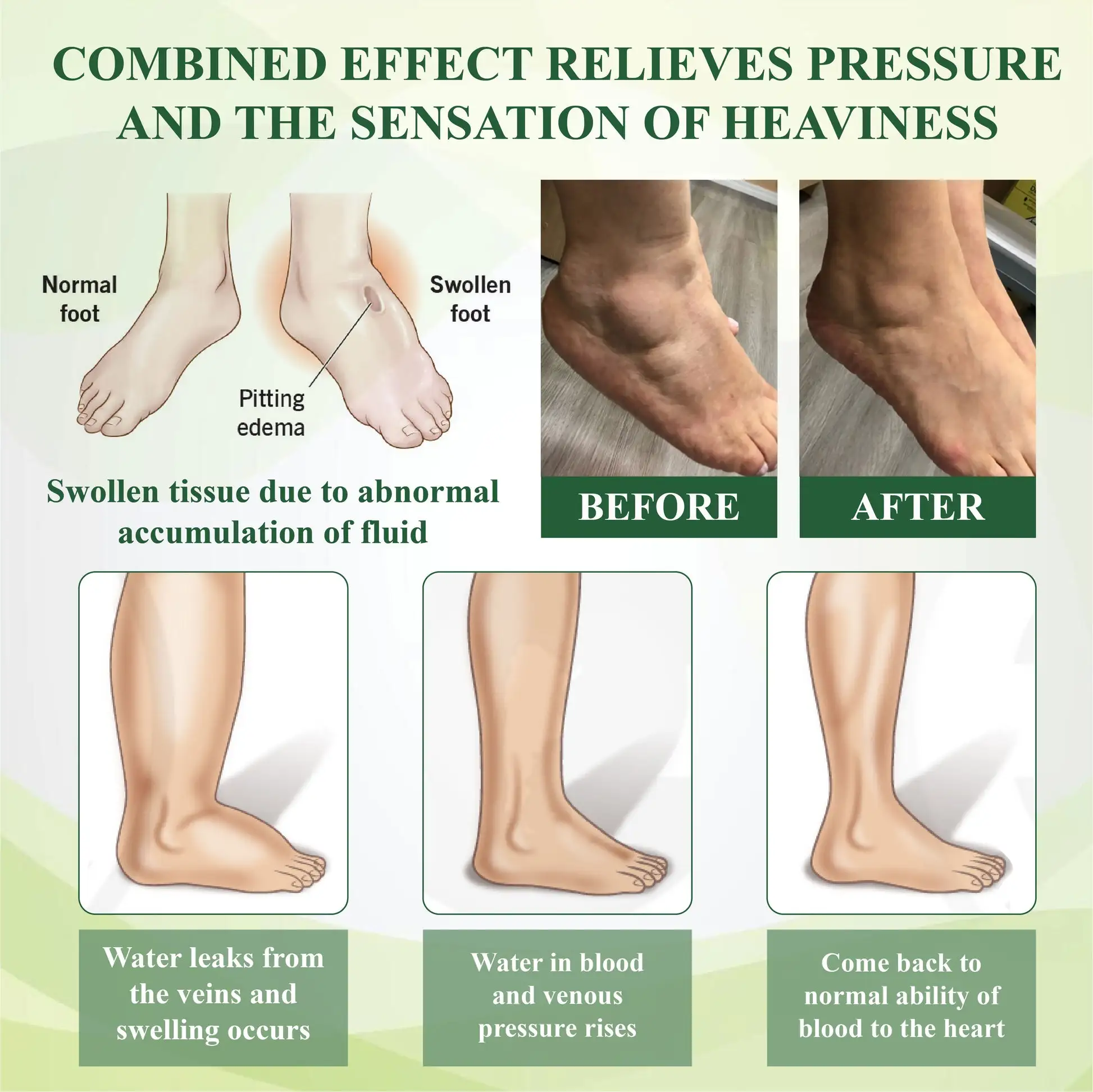 Edema Drain Duo Therapy Roller Cream - Image 6