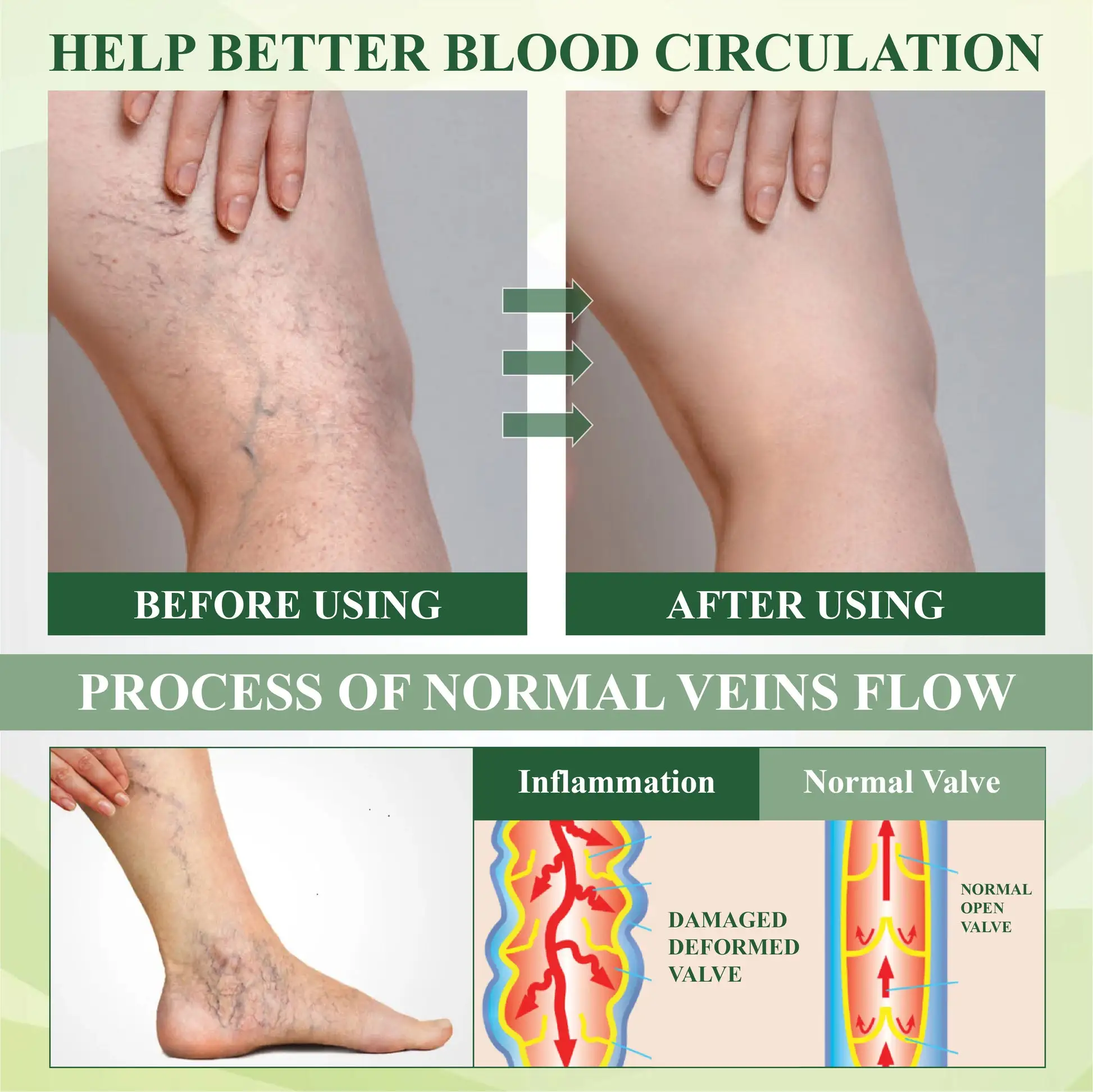 Edema Drain Duo Therapy Roller Cream - Image 7
