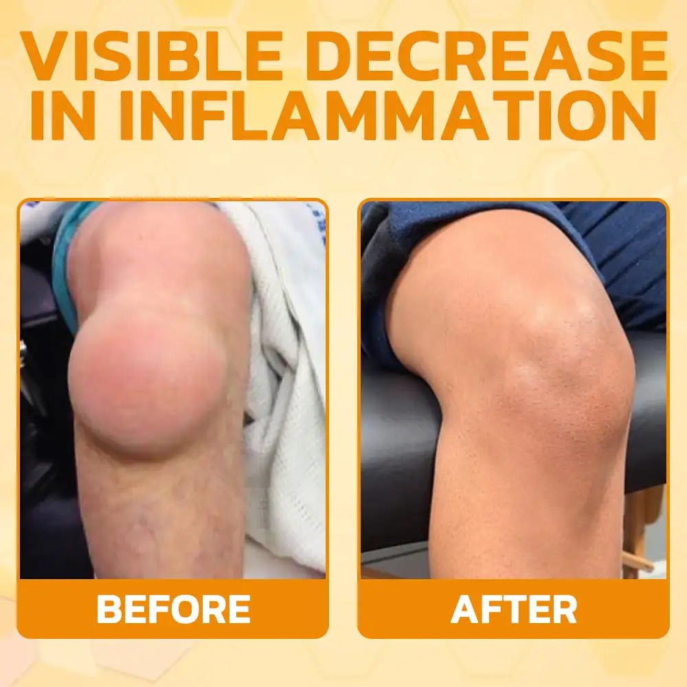 Bee Venom Instant Ultra Strength Pain Relief Therapy Cream - Image 9