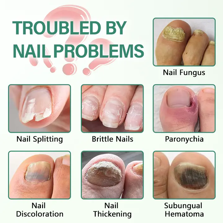 Nail Detox Penetration Serum Pen - Image 8