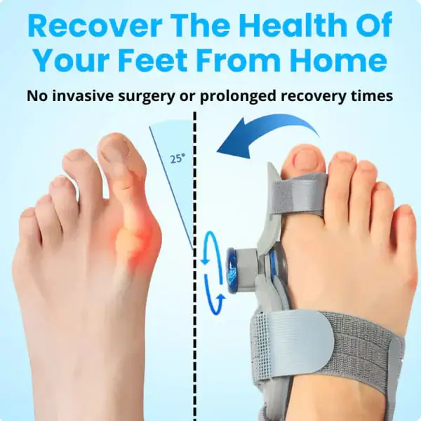 Non-Surgical Relief for Bunion Pain - Image 6