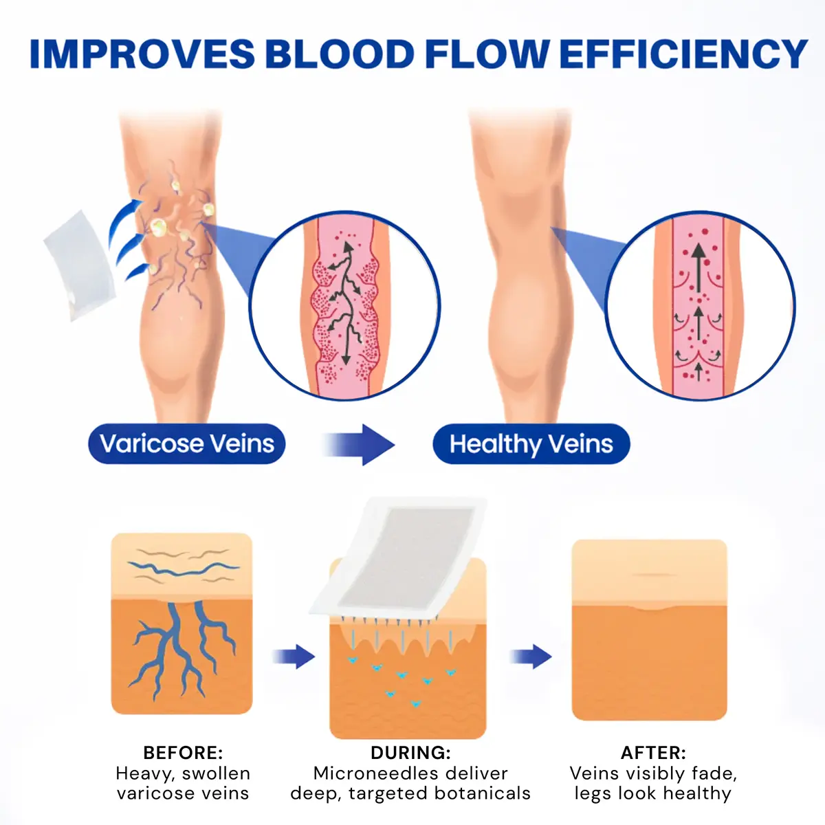 Vein Contour Micro-Patches: The 7-Day Transformation for Varicose Veins - Image 2