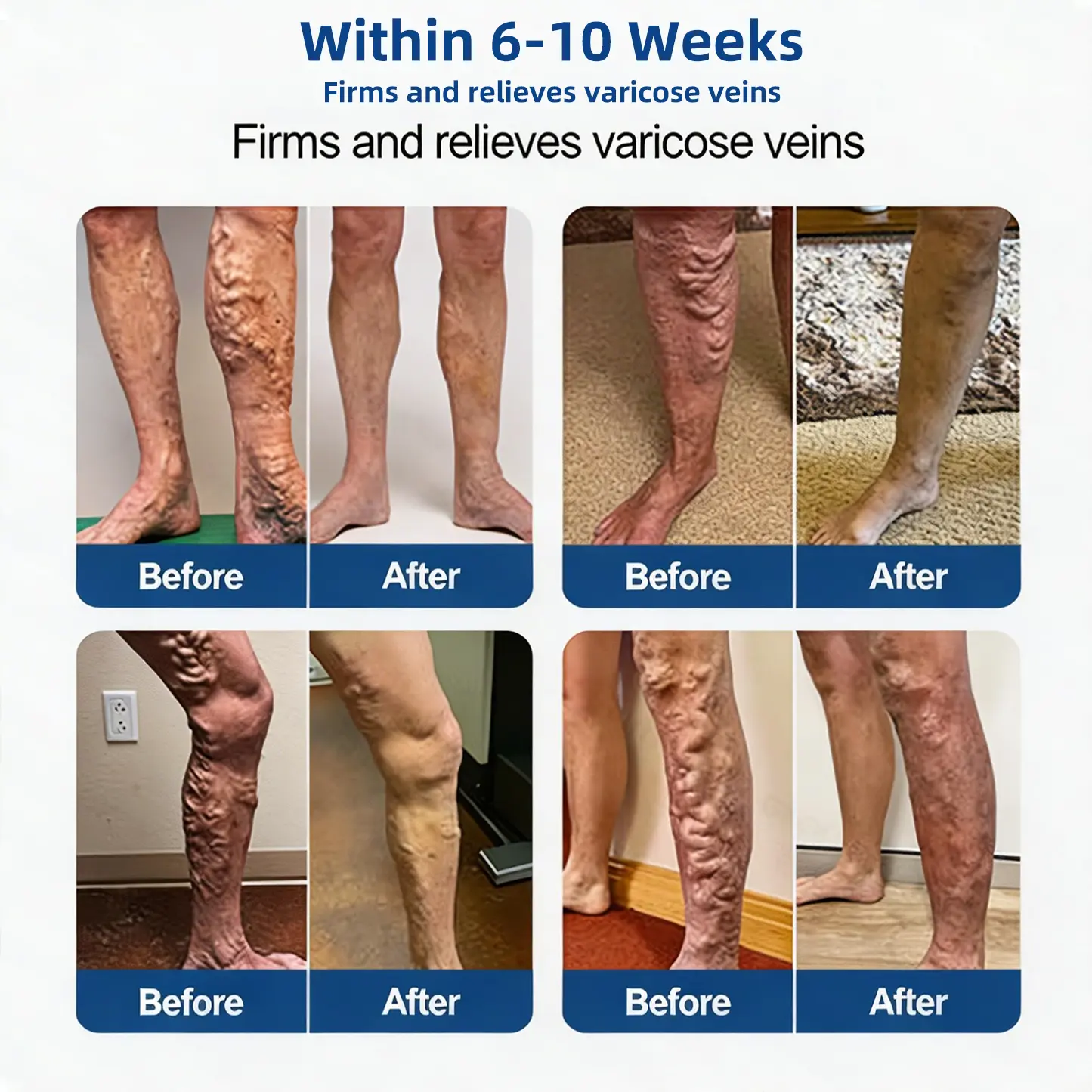 Vein Contour Micro-Patches: The 7-Day Transformation for Varicose Veins - Image 6