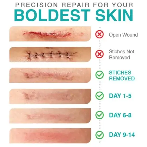 3-in-1 Microneedle Care Patch - Image 5