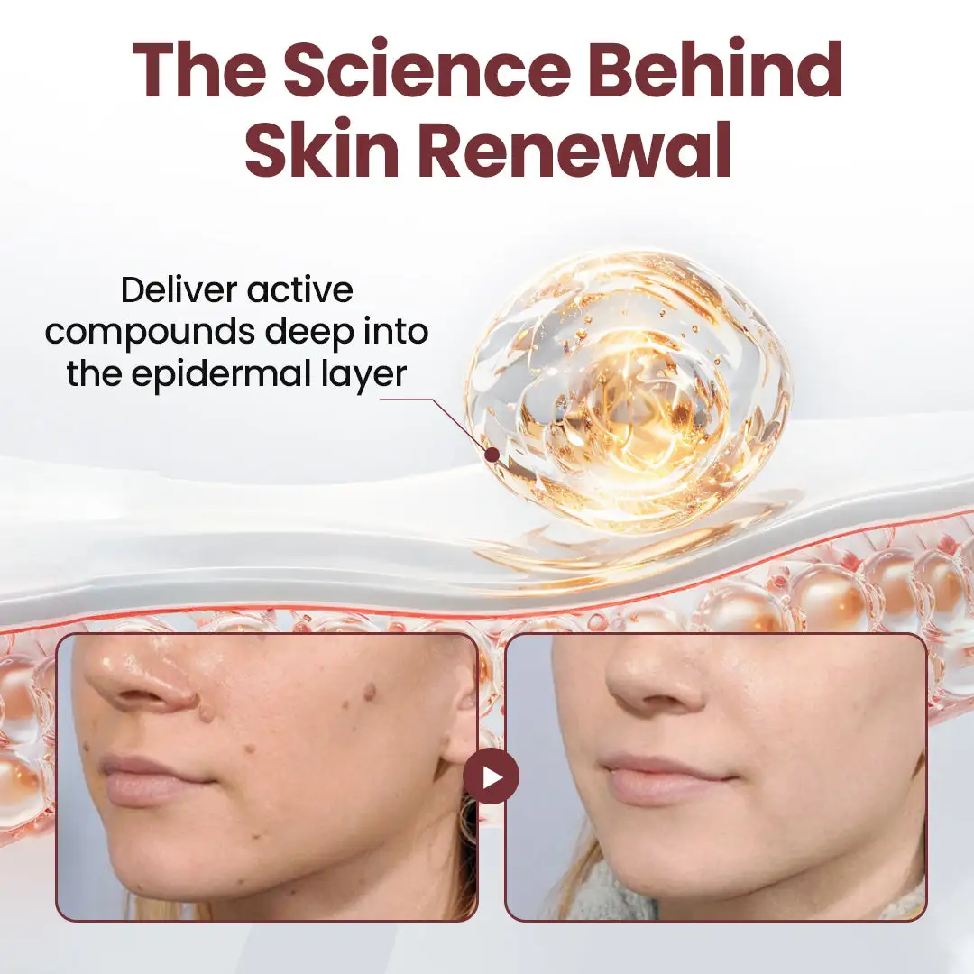 KeraErase Smoothing Dual-Action Renewal Cream - Image 4