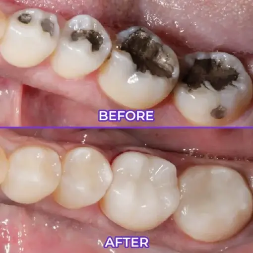 SensiGum Fluoride Toothpaste - Image 5