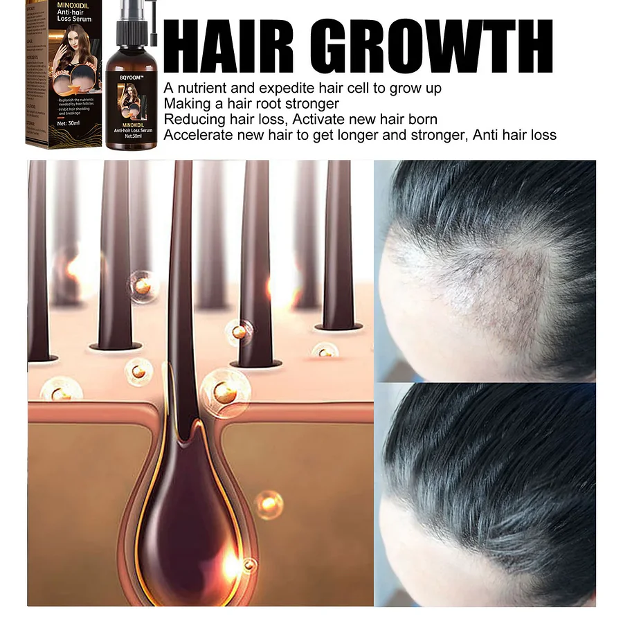Rapid Hair Regrowth Oil - Image 5