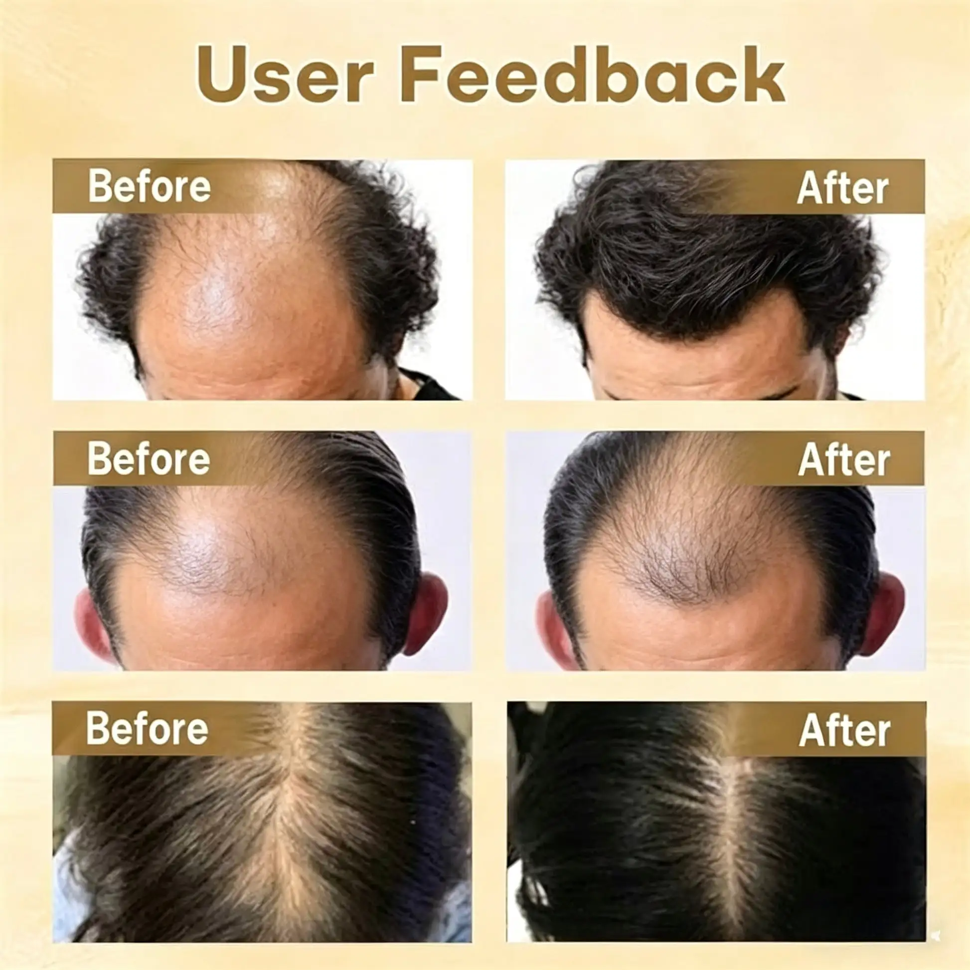 Clinclii Hair Regrowth Capsules - Image 2
