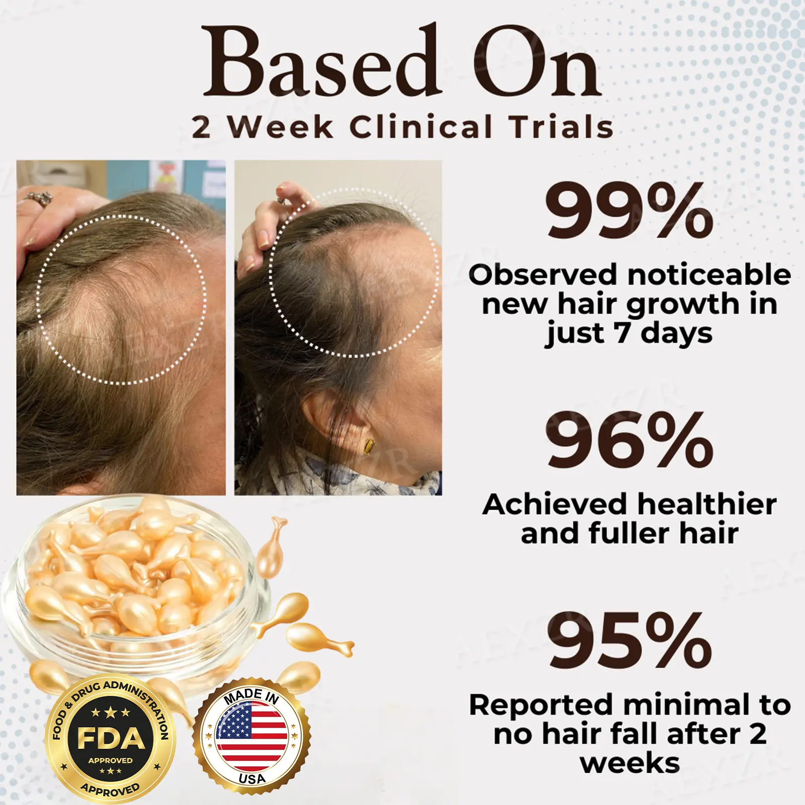 Hair Regrowth Capsules - Image 6