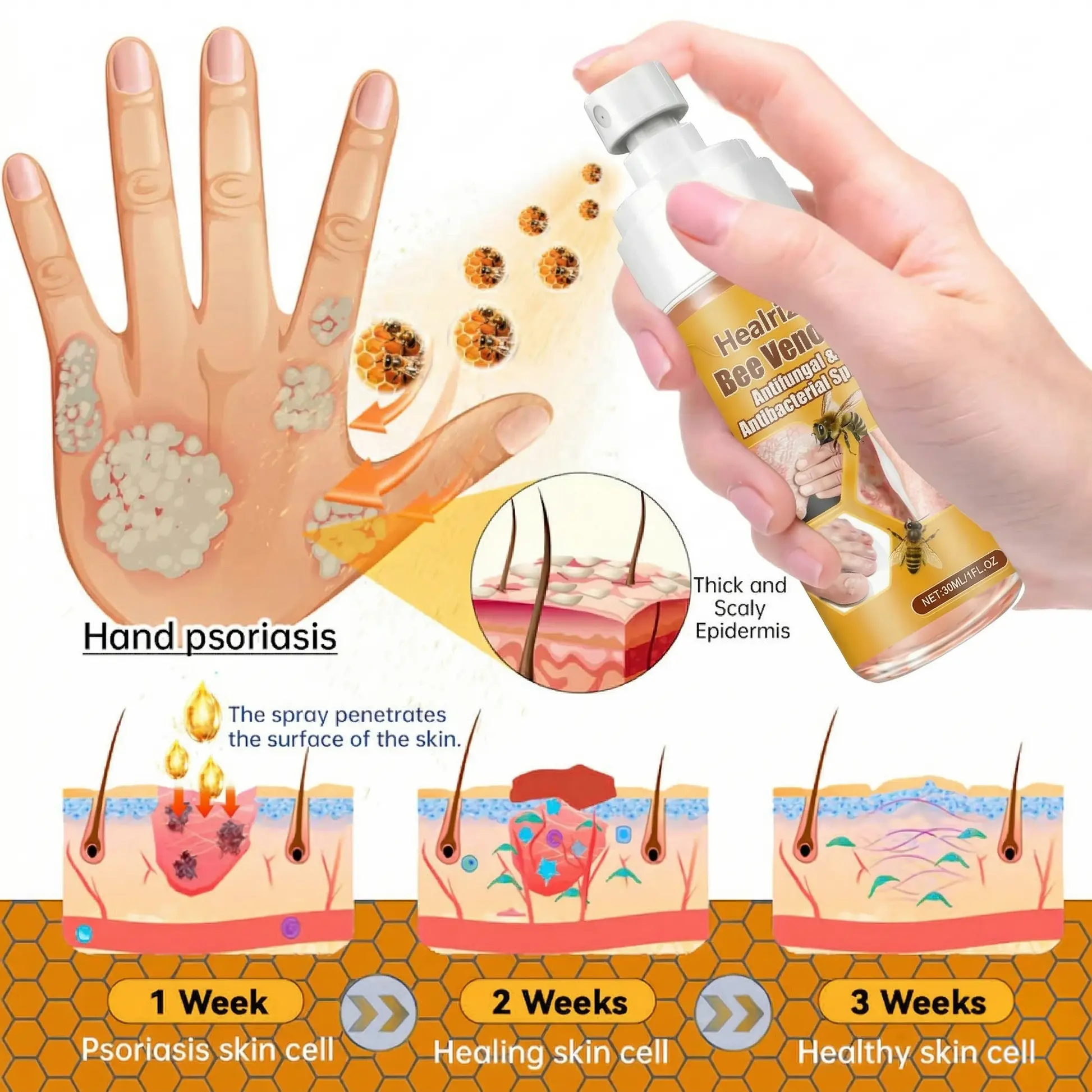 Bee Venom Antifungal & Antibacterial Spray - Image 3
