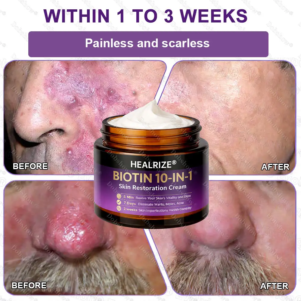 ✨Best Biotin 10-in-1 Skin Restoration Cream - Image 10