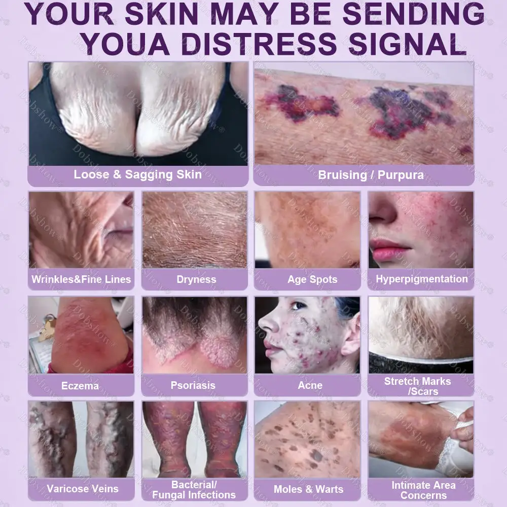✨Best Biotin 10-in-1 Skin Restoration Cream - Image 2