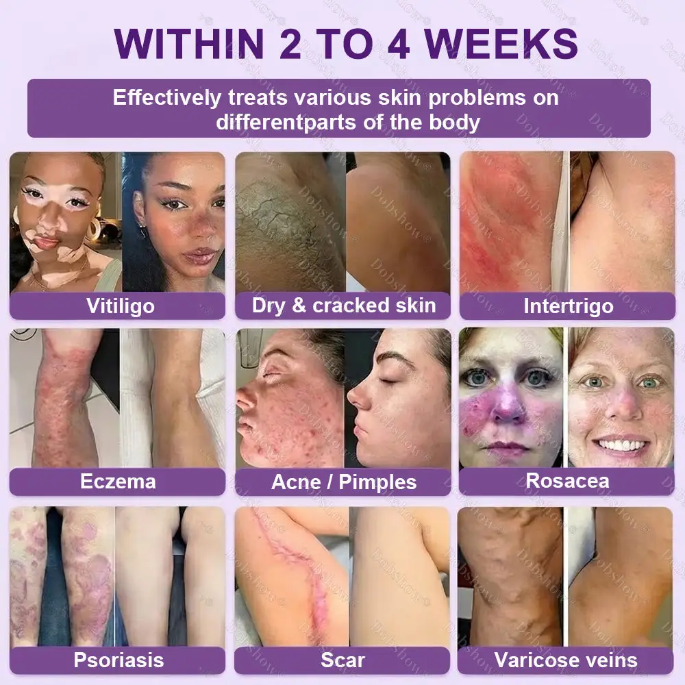 ✨Best Biotin 10-in-1 Skin Restoration Cream - Image 3