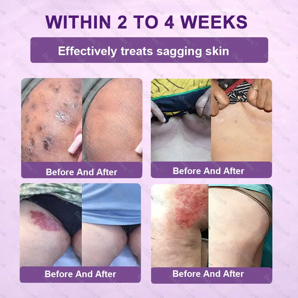 ✨Best Biotin 10-in-1 Skin Restoration Cream - Image 8