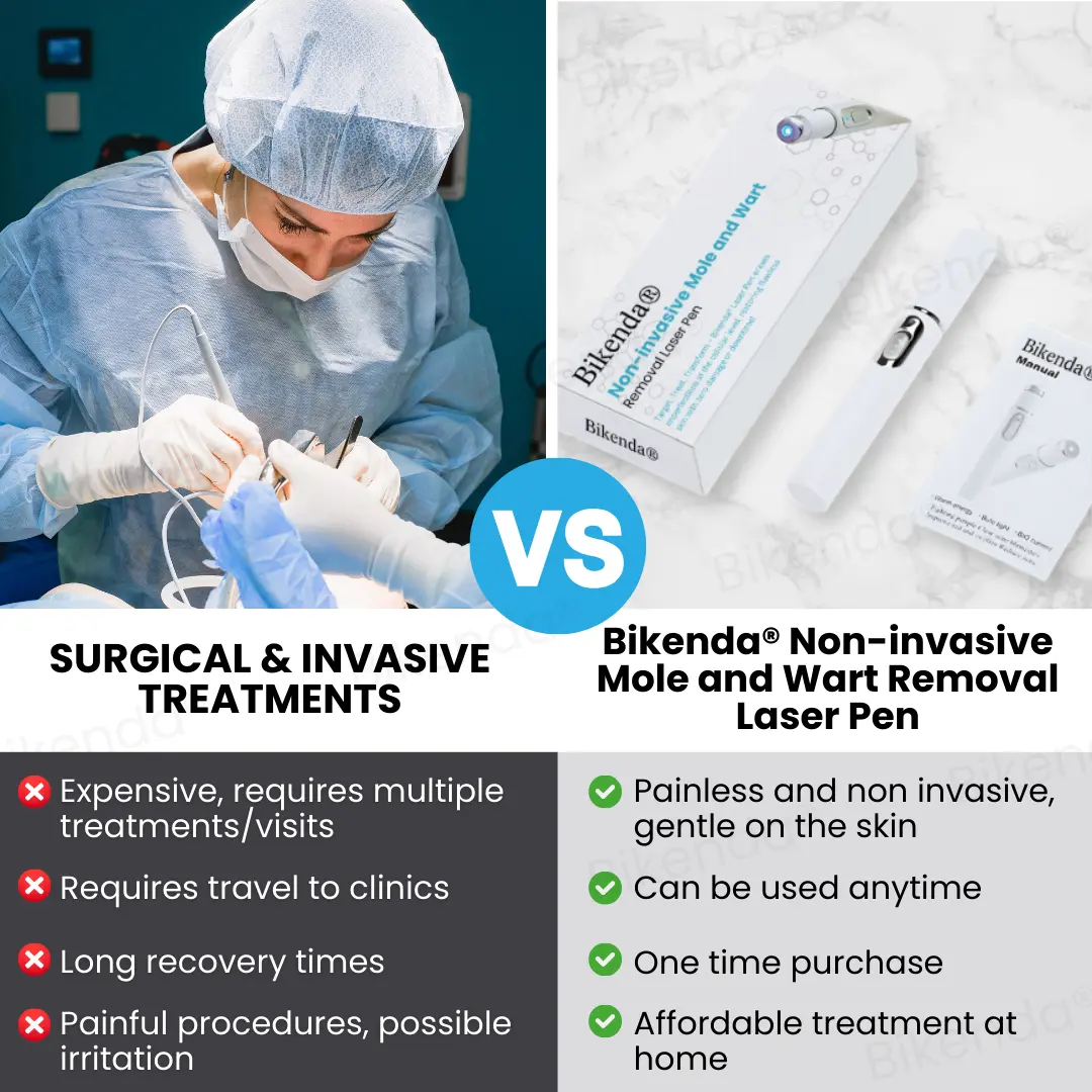 Non-invasive Mole and Wart Removal Laser Pen - Image 8