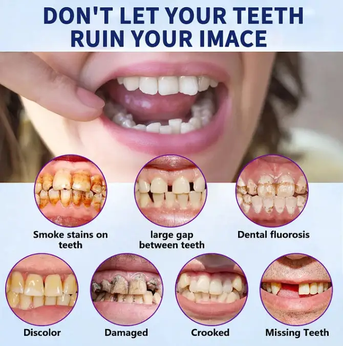 Advanced Full Denture Set - Image 8