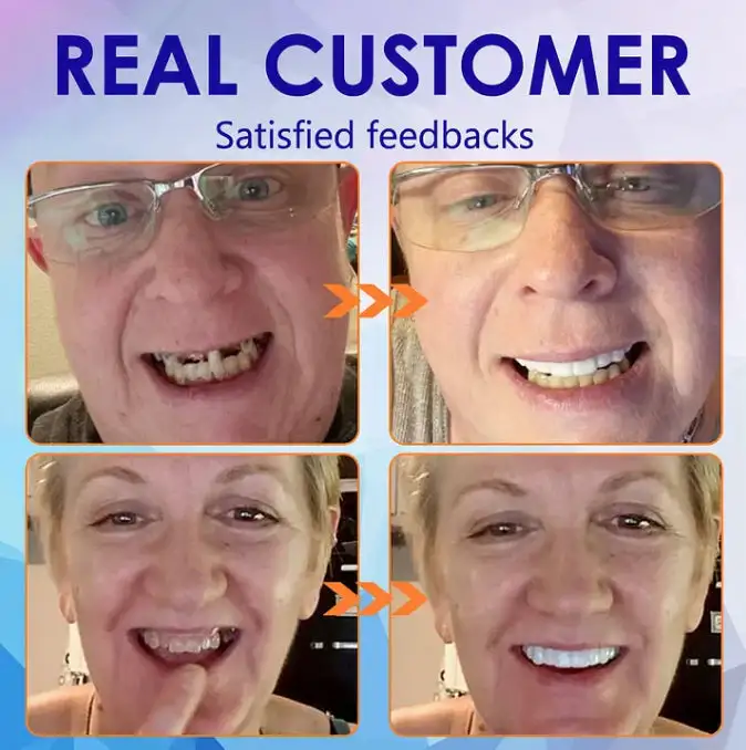 Advanced Full Denture Set - Image 9